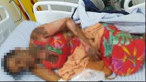Imagem Mulher que teve 70% do corpo queimado morre após mais de 20 dias de internação