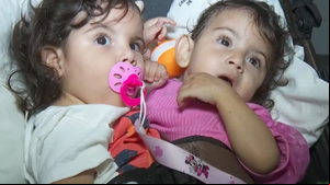 Gêmeas am por cirurgia de separação, em Goiás - Foto: Reprodução/TV Anhanguera