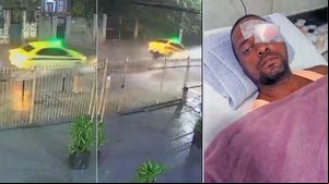 Tampa solta de bueiro faz carro 'voar' e taxista perde a visão de um olho - Reprodução / TV Globo