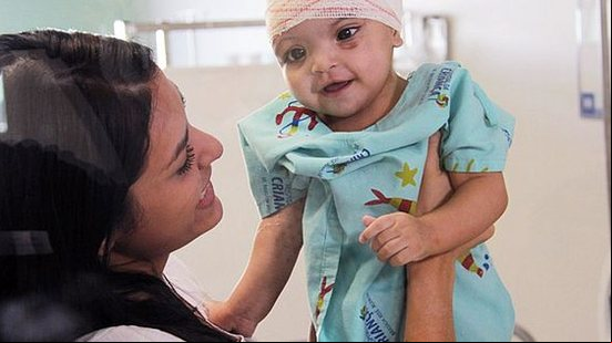 Foto: Divulgação - Hospital da Criança de Brasília