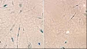 Resultados de experimentos feitos em células cerebrais humanas sugerem que o medicamento retarda o envelhecimento celular | Divulgação